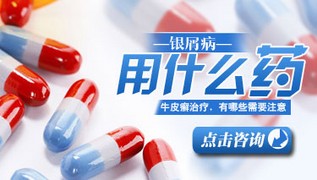 牛皮癣患者如何使用激素类药物治疗