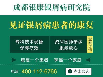 牛皮癣的主要症状有哪些